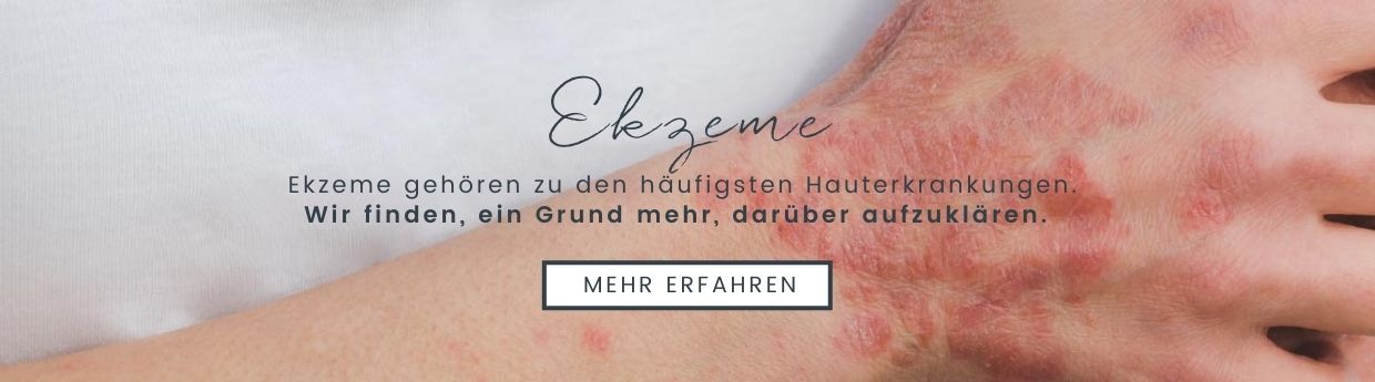 Ekzeme gehören zu den häufigsten Hauterkrankungen