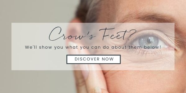 Crow's Feet