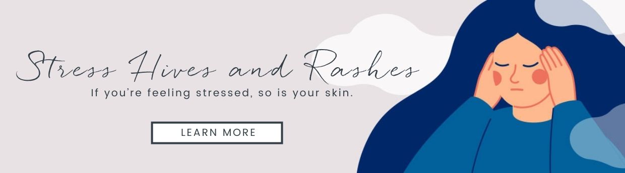 Stress Hives and Rashes