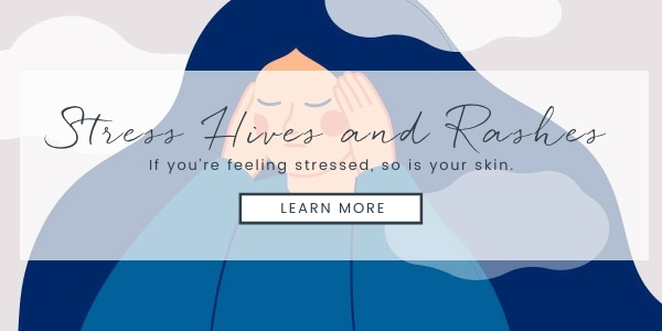Stress Hives and Rashes