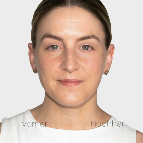 BB Cream für unreine Haut