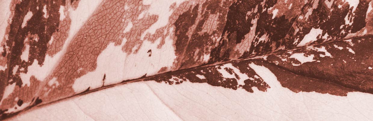 Melasma – Pigmentflecken in der Schwangerschaft Hyperpigmentierung und Melasmen in der Schwangerschaft