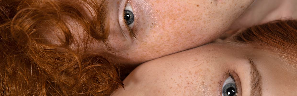 Pigmentstörung – Ursache & Behandlung Die verschiedenen Formen von Pigmentstörungen: Von Hyperpigmentierung bis Vitiligo