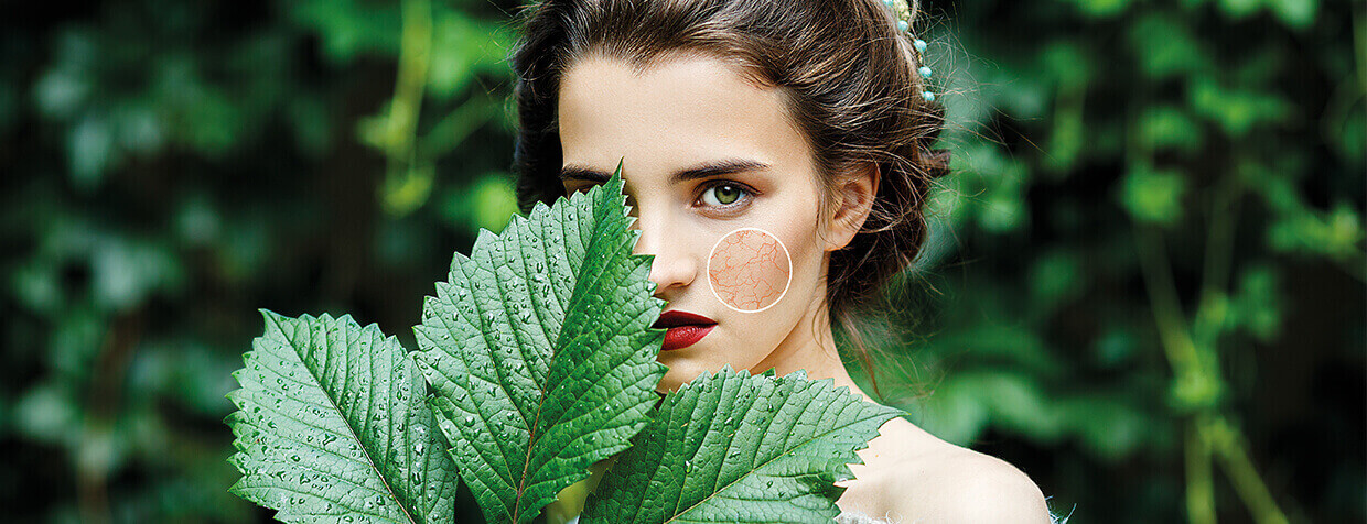 Couperose Skin Couperose and skin prone to redness