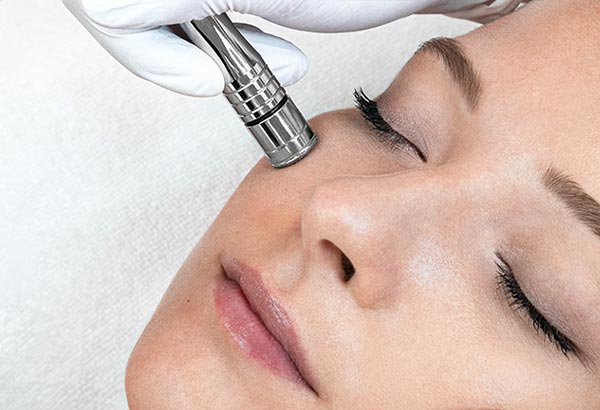 DMA100 Microdermabrasion treatment