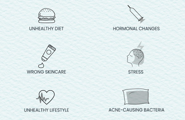 Causes of Acne