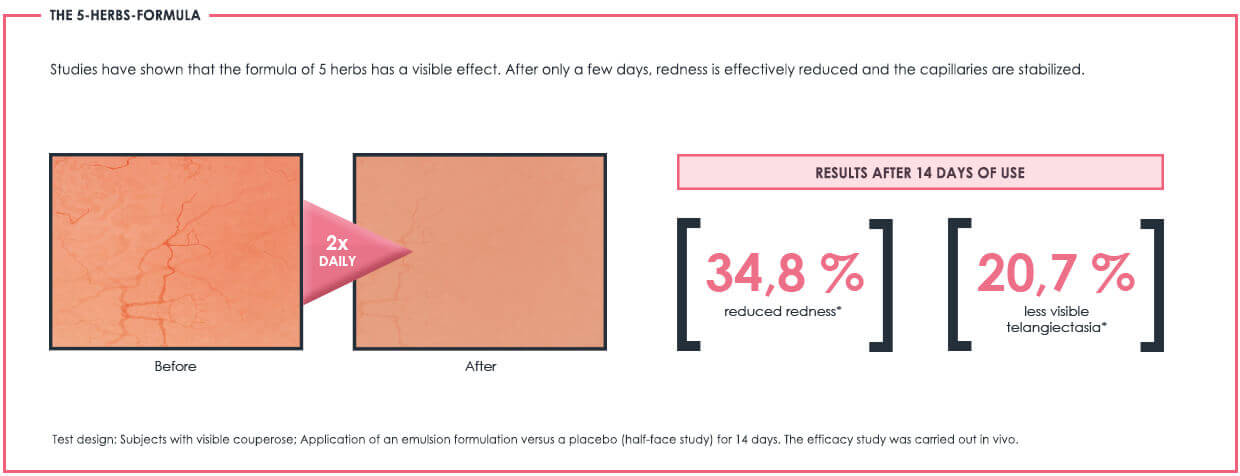 Redness Control Study Results Impressive test results Redness Control Couperose collection