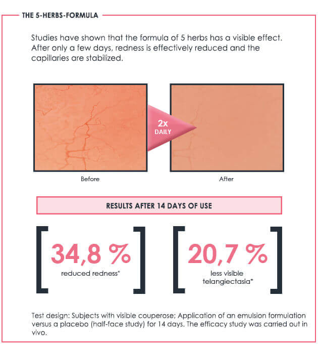 Redness Control Study Results Impressive test results Redness Control Couperose collection