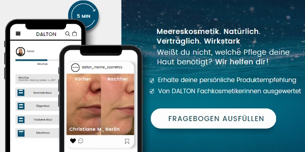 Fragebogen ausfüllen und Produktempfehlung erhalten