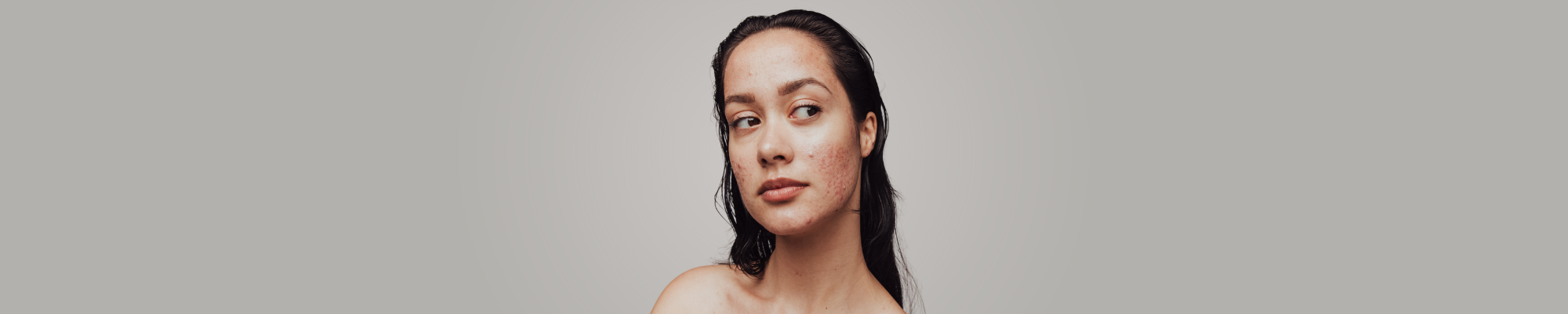 Skincare for acne prone skin Removing facial blemishes
