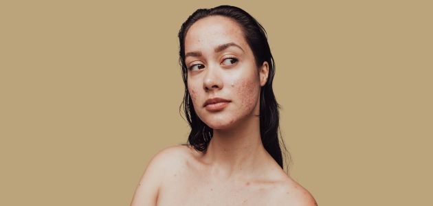 Non-comedogenic skincare What does comedogenic mean