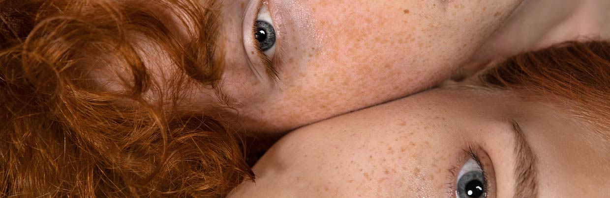Die verschiedenen Formen von Pigmentstörungen: Von Hyperpigmentierung bis Vitiligo