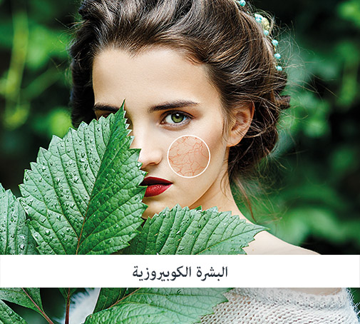 البشرة الكوبيروزية والاحمرار