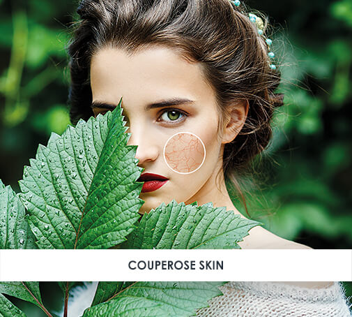 Couperose Skin and Redness
