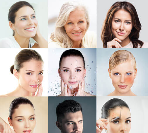 Altri tipi di pelle Altri tipi di pelle