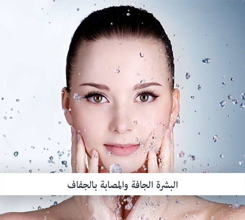 البشرة الجافة والمصابة بالجفاف