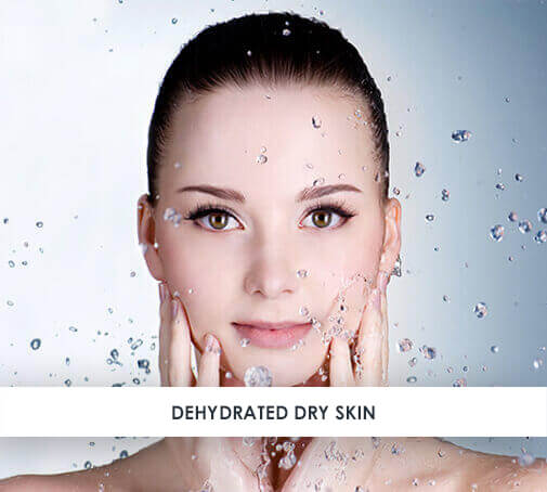 Dry and dehydrated skin