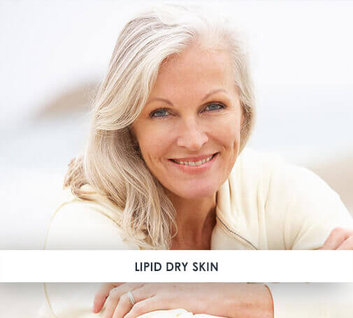 Dry skin lacking oil