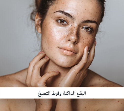 بقع التصبغ والبشرة الغير متساوية اللون