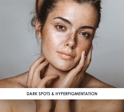Hyperpigmentation and uneven skin tone