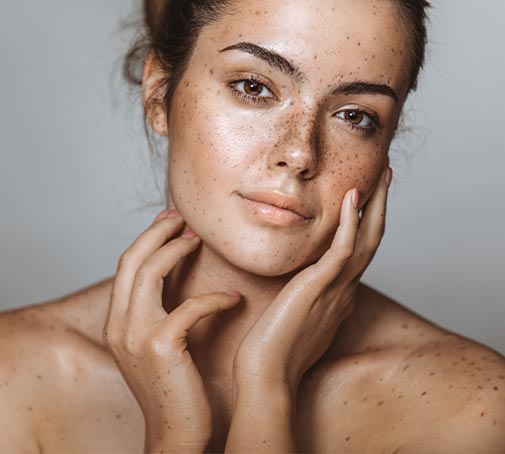 How to get rid of dark spots