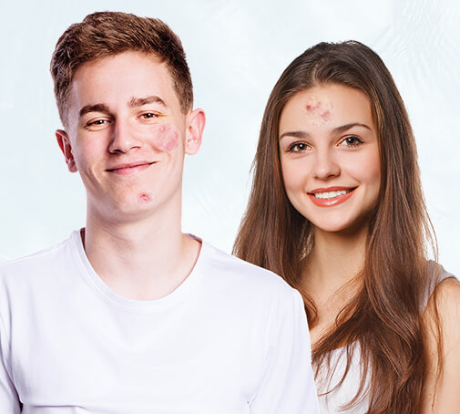 Erfahre mehr zu unreiner, zu Akne neigender Haut