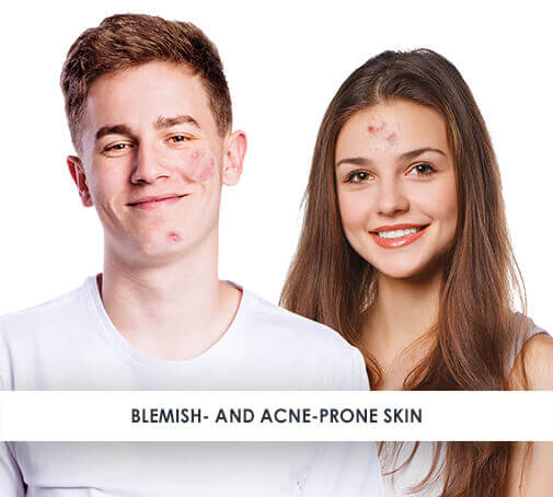 Skincare for blemish-prone skin