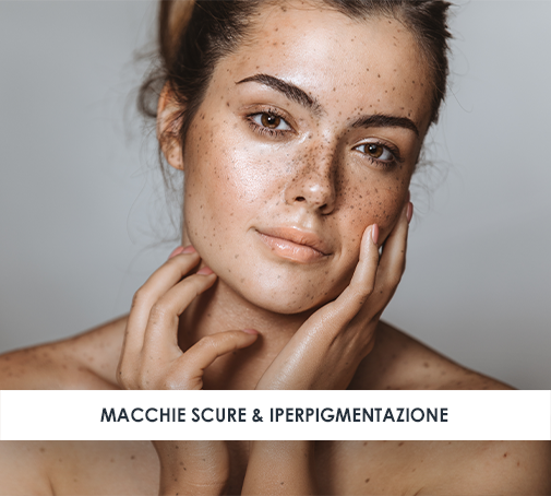 Macchie scure & Iperpigmentazione