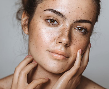 اضطرابات التصبغ