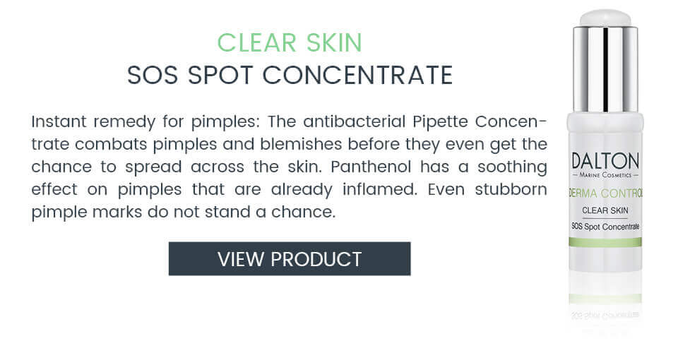 Antibacterial emergency remedy for pimples