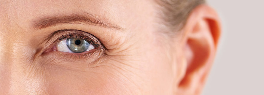 How to prevent crow’s feet eyes