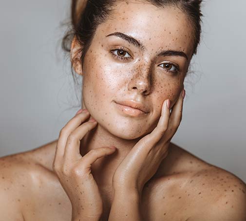 Eliminare macchie scure, macchie dell’età, iperpigmentazione e segni post-acne