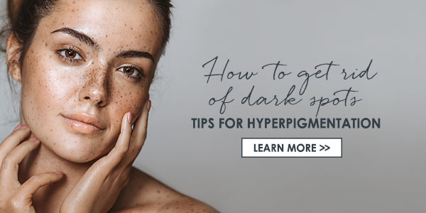  How to remove age spots 