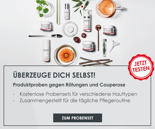 Was tun bei Couperose