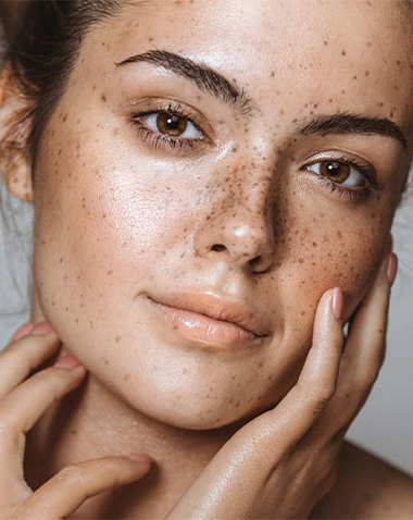 اضطرابات التصبغ