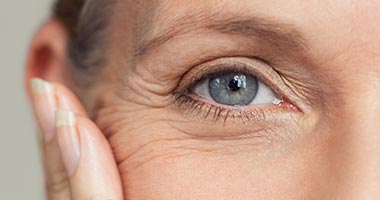 Was sind Krähenfüße? Tipps gegen tiefe Falten an den Augen