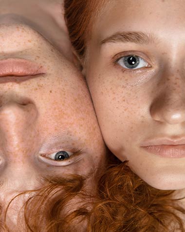 Disturbi della pigmentazione 