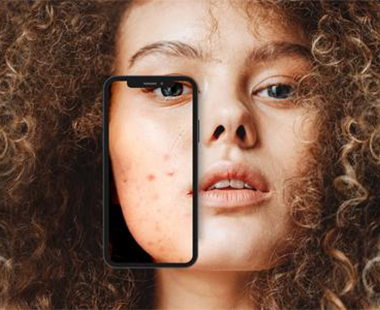 Mehr erfahren Skin Stories