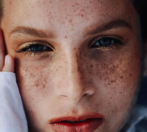 Sensitive skin How to care for sensitive skin