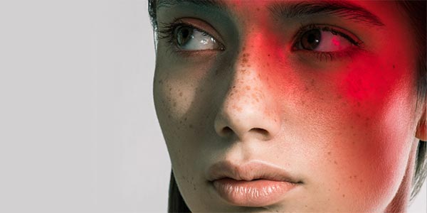 Causes of redness on the skin Difference between rosacea and sensitive skin