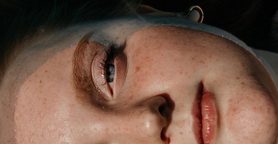 Sensitive skin symptoms How to tell if you have sensitive skin