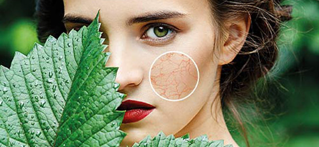 How to deal with couperose? Couperose - Control skin prone to redness