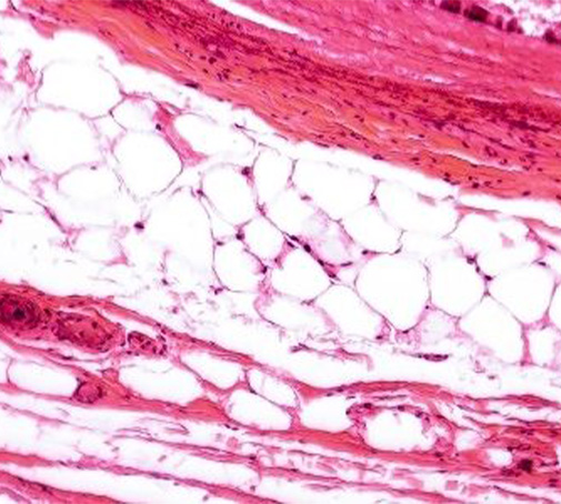 Kollagen gegen Falten