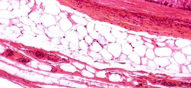 Ursache und Behandlung von Pigmentstörungen
