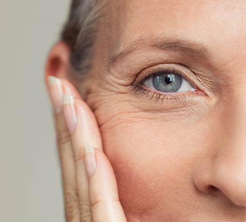 Krähenfüße Behandlung von Augenfalten