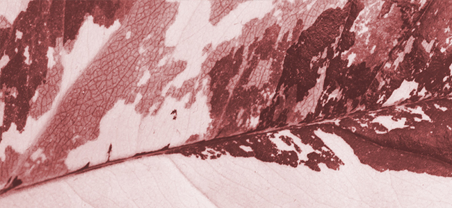 Melasma - Hormonal Hyperpigmentation