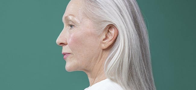 Wechseljahre Hautprobleme in den Wechseljahren