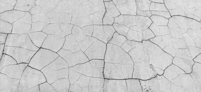 Tipps gegen trockene Haut
