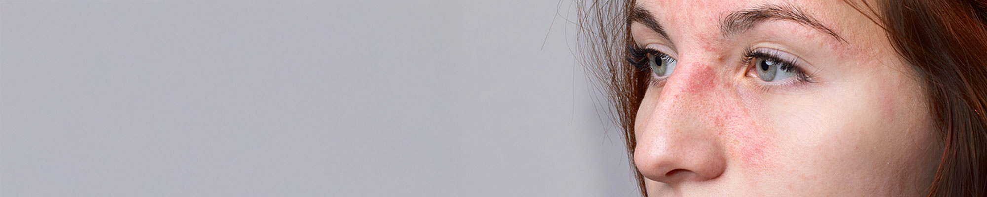 Überempfindliche Haut richtig pflegen