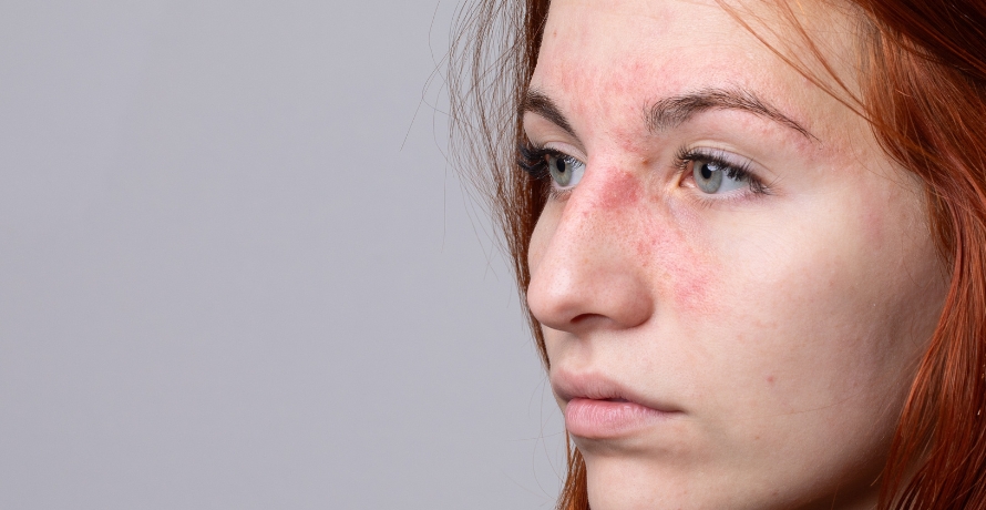 Sehr empfindliche, zu Allergien neigende Haut